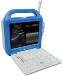 Digital Laptop Ultrasound Scanner/ultrasound uses/ private ultrasound/ultrasound scans
