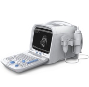 Ultrasound Scanner -Portable Ultrasound -MD3100