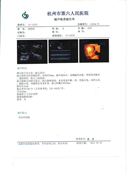 Medical Color ultrasound film