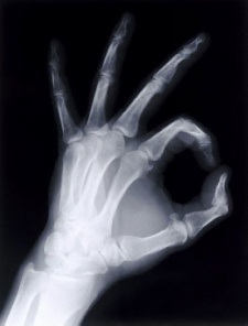 x-ray film